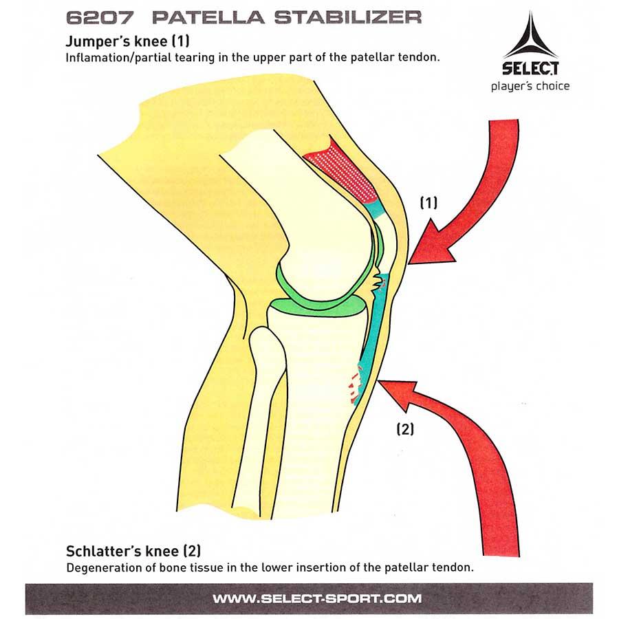 Наколінник SELECT 6207 Knee support for jumper's knee (228) чорн/зел, XXL - #5